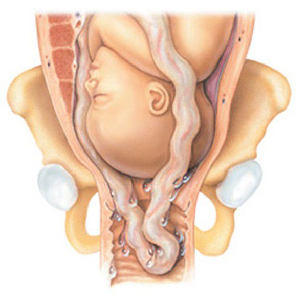 Một vài điều thú vị về dây rốn mẹ bầu nên biết 2